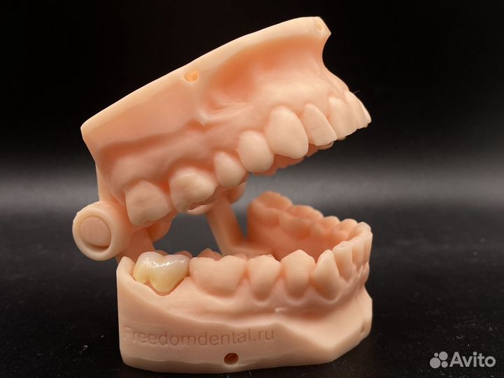 Коронка циркониевая/ e-max наготово по интраоральн