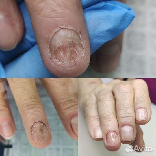 Подология. Педикюр. Медицинский педикюр