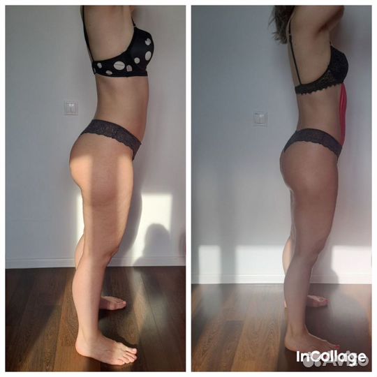 Антицеллюлитный массаж / коррекция фигуры