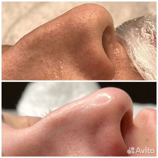 Косметолог (чистка лица, пилинг, маски)