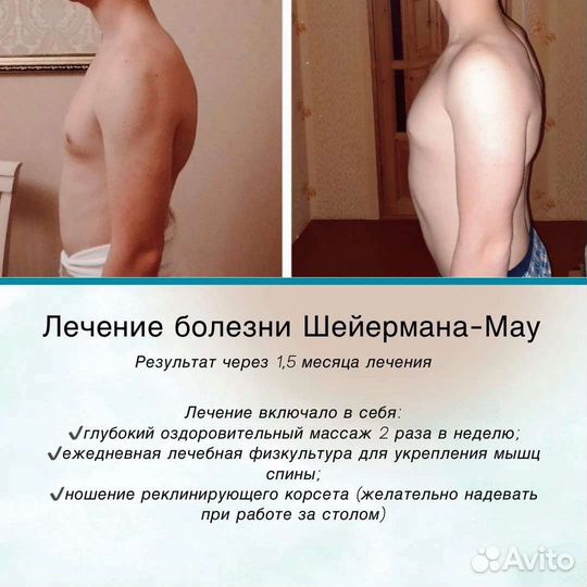 Антицеллюлитный массаж
