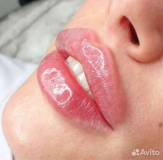 Биоревитализация