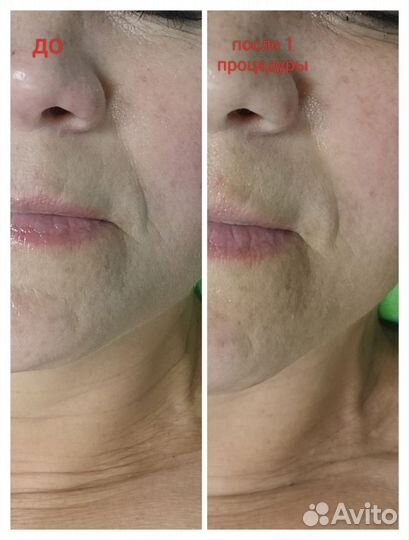 Оздоровительный массаж фохоу