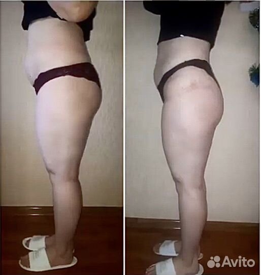 Массаж ручной и аппаратный