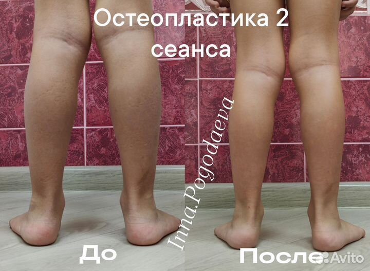 Массаж,женский мастер