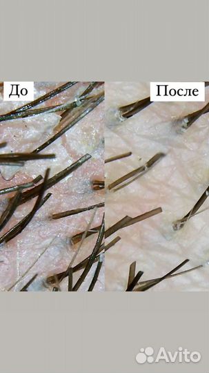 Кератиновое выпрямление/ботокс/женские стрижки