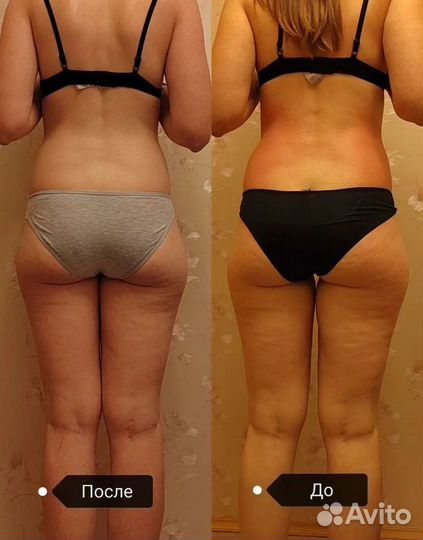 Массажистка