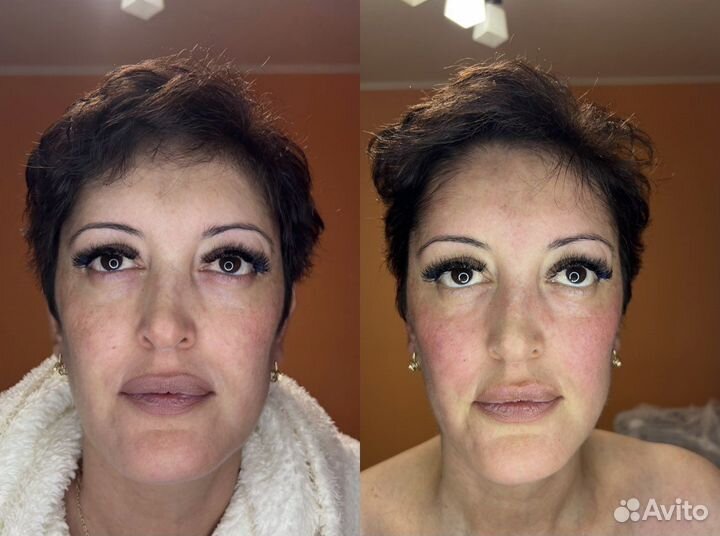 Массаж лица