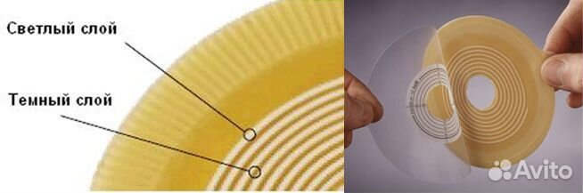 177100 Alterna нового поколения пластина с креплен