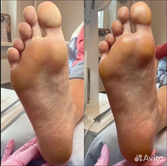 Smart педикюр от лицензированного мастера