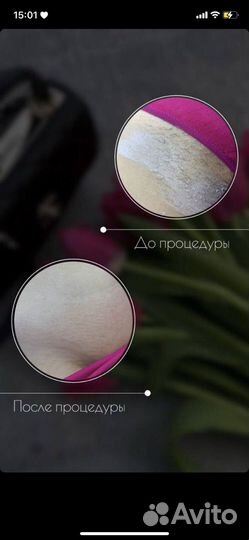 Спа-шугаринг