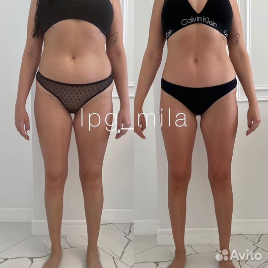 Ручная липосакция, массаж