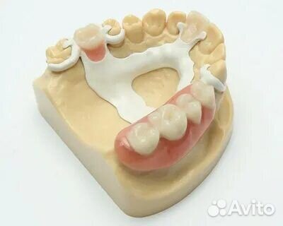 Металлокерамика/Цирконий/Виниры/Съёмные протезы