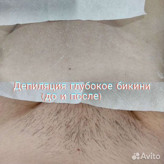 Восковая депиляция