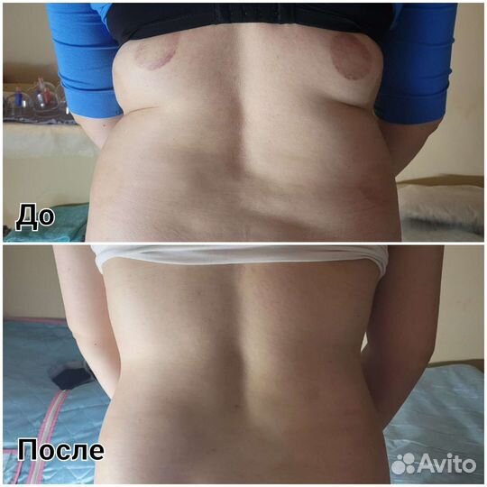 Массаж для женщин