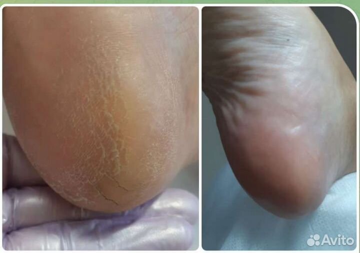 Маникюр Педикюр