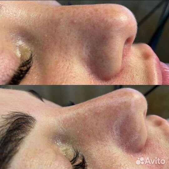 Массаж на дому