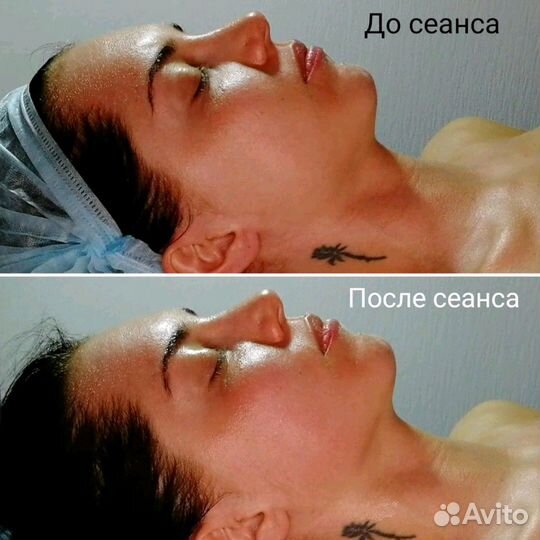 Лифтинг-массаж лица