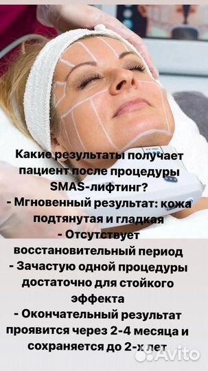 Smas - лифтинг (безопеционная подтяжка кожи)