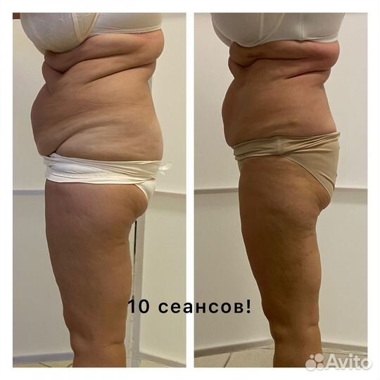 Массаж м.Кировский завод, только для Женщин