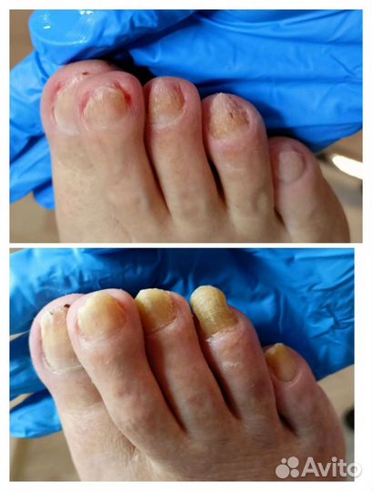 Услуги подолога