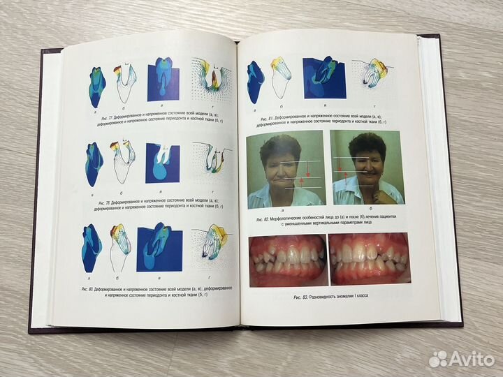 Деформации и Аномалии Челюстно-лицевой области