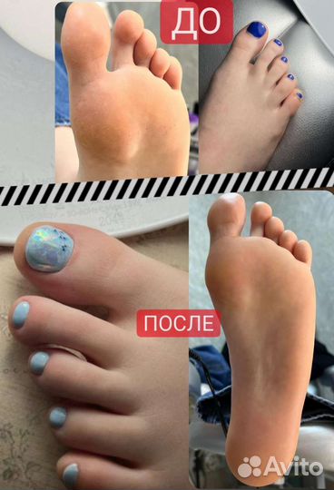 Аппаратный педикюр
