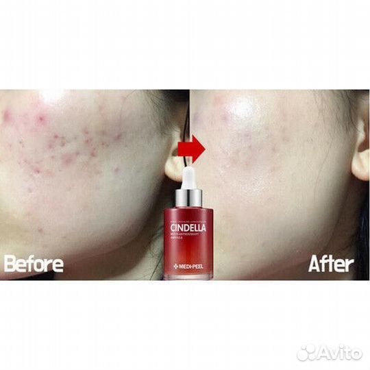 Medi peel Сыворотка