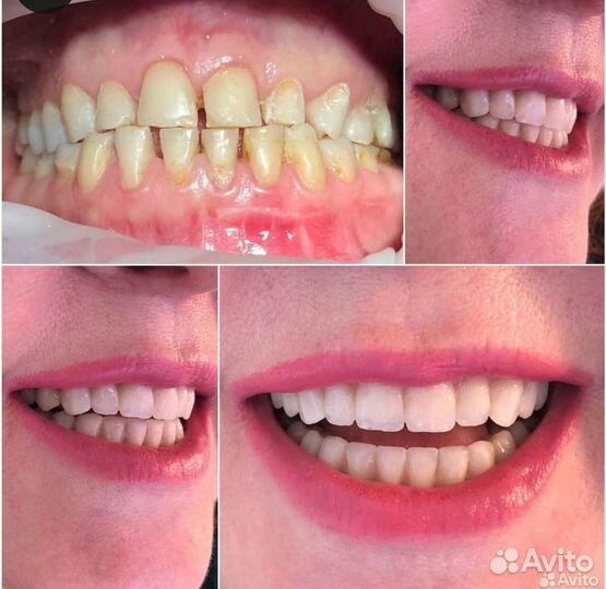 Врач Стоматолог - ортопед