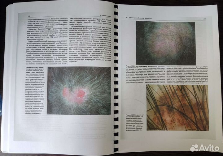 Атлас трихоскопии