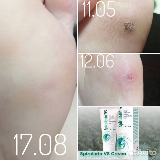 Подолог Феодосия