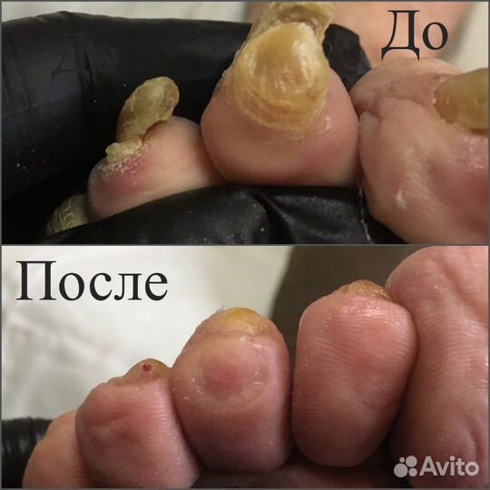 Педикюр маникюр подолог выезд на дом
