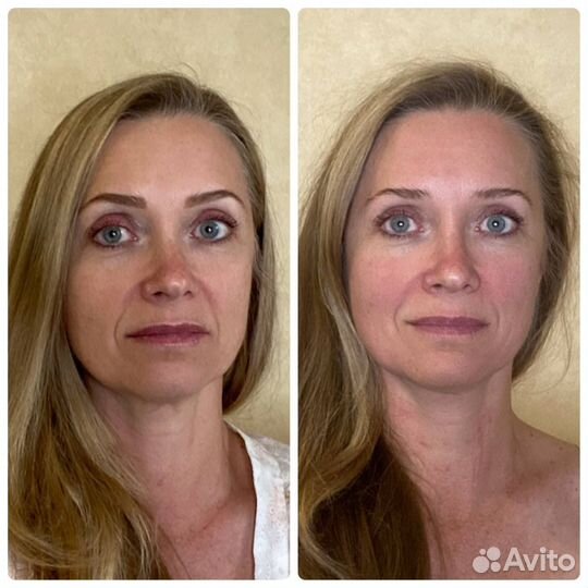 Скульптурирующий массаж лица