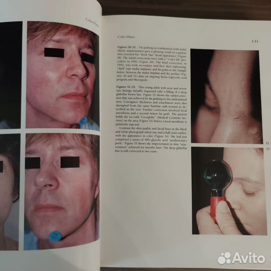 Практические процедуры в эстетической пластике