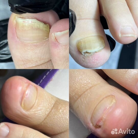 Педикюр (не.мед подолог)