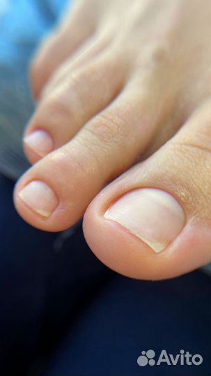 Педикюр гигиена и эстетика, без подологии