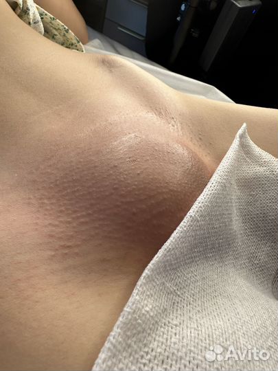 Шугаринг & Воск / депиляция