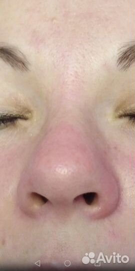 Шугаринг депиляция