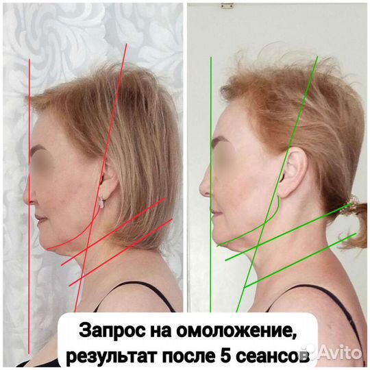 Восстановление естественной красоты