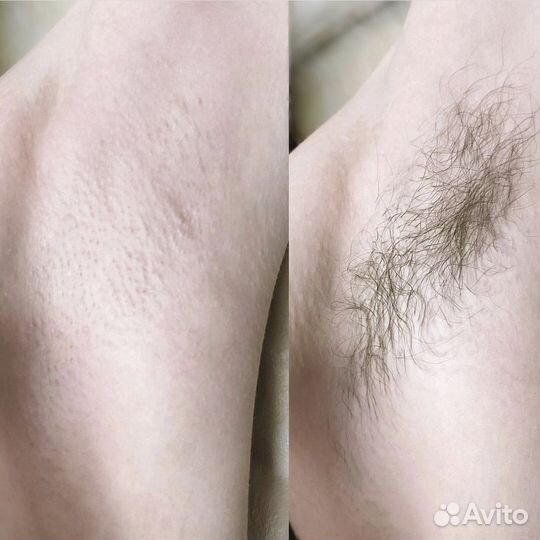 Шугаринг мужской & женский