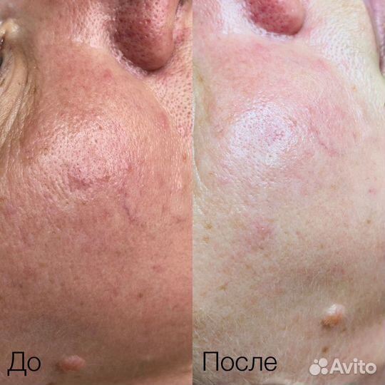 Услуги косметолога