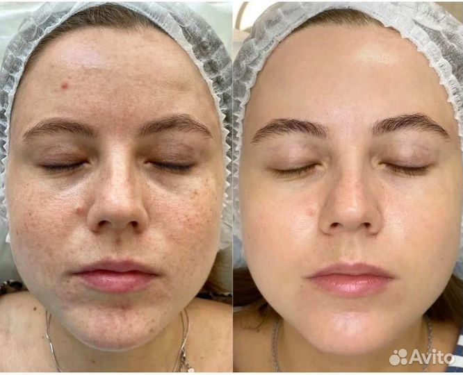 Косметолог модели на процедуры красоты