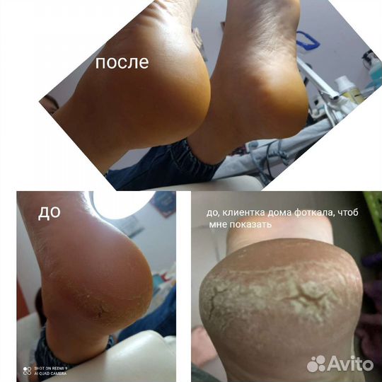 Маникюр,смарт педикюр,карт педикюр