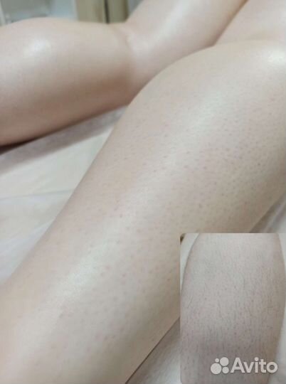 Шугаринг и ваксинг