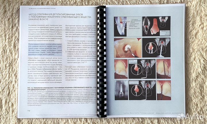 Адгезивные керамические реставрации