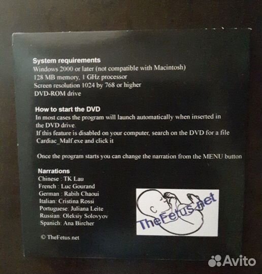 Уз-диагностика аномалий сердца плода. CD