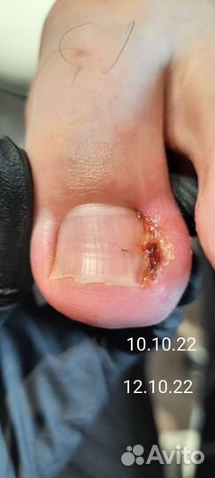 Услуги подолога