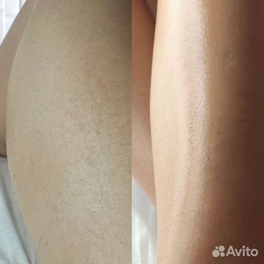 Депиляция, шугаринг. Парк Победы