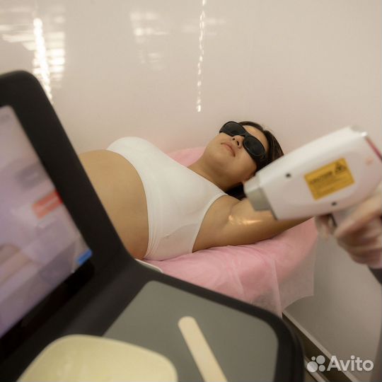 Лазерная эпиляция