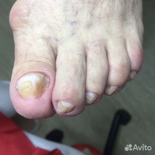 Модель на педикюр